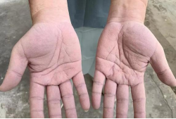 1657850734621052.png image.png